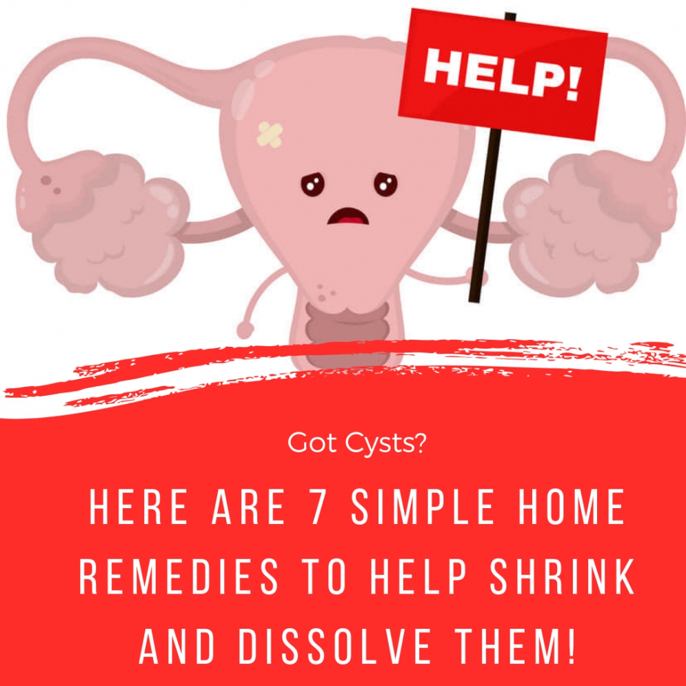 7 Home Remedies To Shrink And Dissolve Ovarian Cysts
